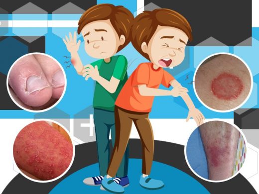 Common Bacterial Skin Infections
