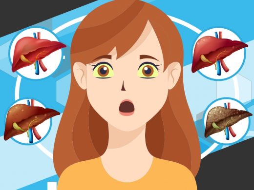 Symptoms of Liver Disease