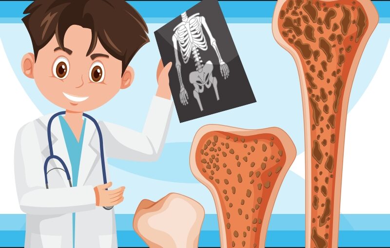 Why is Bone Health Important?