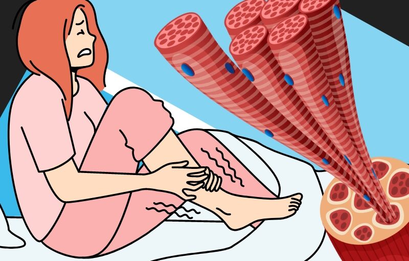 What are Muscular Cramps?